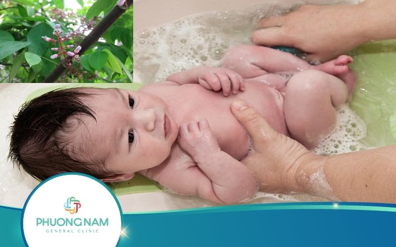 Cách Tắm Lá Khế Trị Mụn Sữa Cho Trẻ Hiệu Quả Nhất
