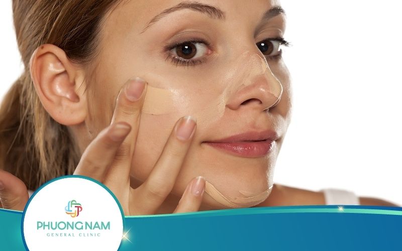 Cách Che Vết Thâm Tạm Thời Siêu Hiệu Quả Bạn Nên Thử