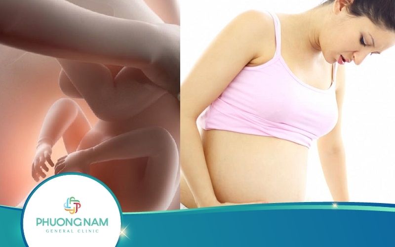 Thai Nhi Đạp Gần Cửa Mình Có Nguy Hiểm Không?