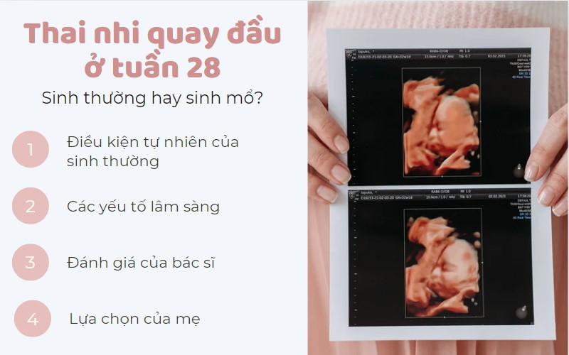 thai nhi quay đầu ở tuần 28 có sao không