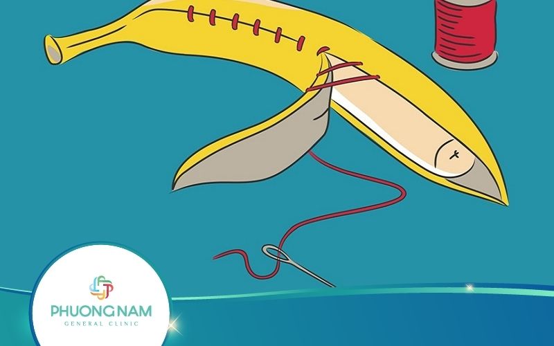 Dài Bao Quy Đầu Có Nên Cắt Không? Khi Nào Nên Thực Hiện?