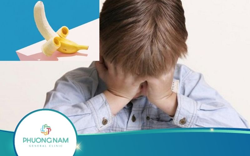 Bao Nhiêu Tuổi Thì Lột Bao Quy Đầu? – Bác Sĩ Giải Đáp