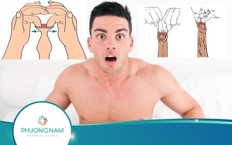 Cách Lột Bao Quy Đầu An Toàn – Nhanh Chóng – Hiệu Quả Tại Nhà