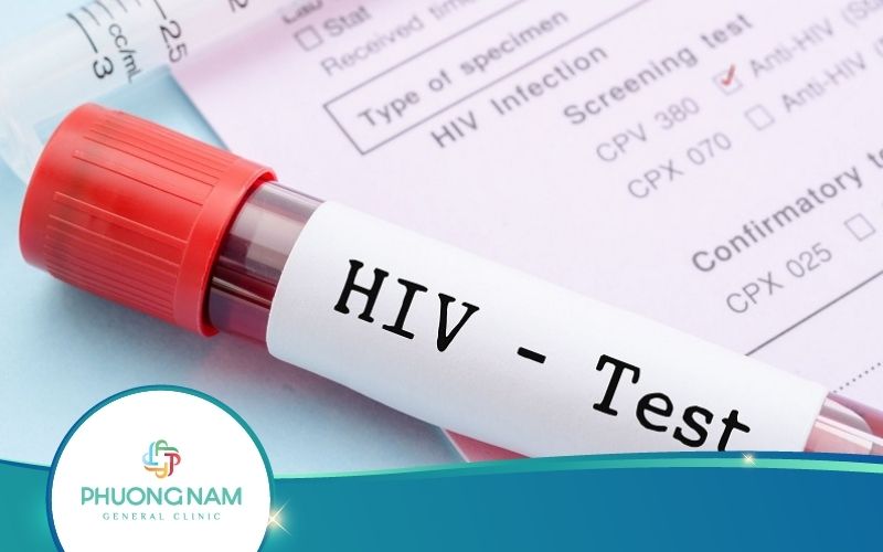 Khám Sức Khoẻ Công Ty Có Xét Nghiệm Hiv Không?