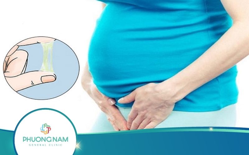 Mang Thai 3 Tháng Đầu Ra Dịch Màu Vàng Nguyên Nhân Do Đâu?