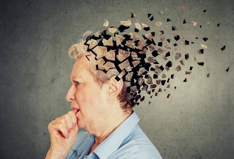 Dấu hiệu bệnh Alzheimer giai đoạn cuối