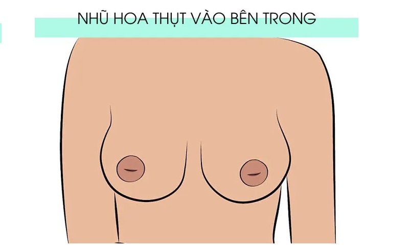 hinh-anh-nhu-hoa-binh-thuong-3