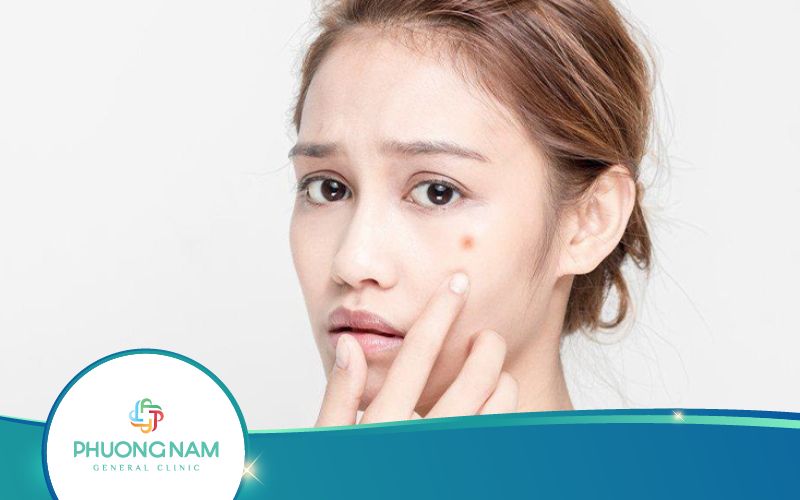 Trị mụn bằng nước bọt vào lúc sáng sớm hiệu quả bất ngờ
