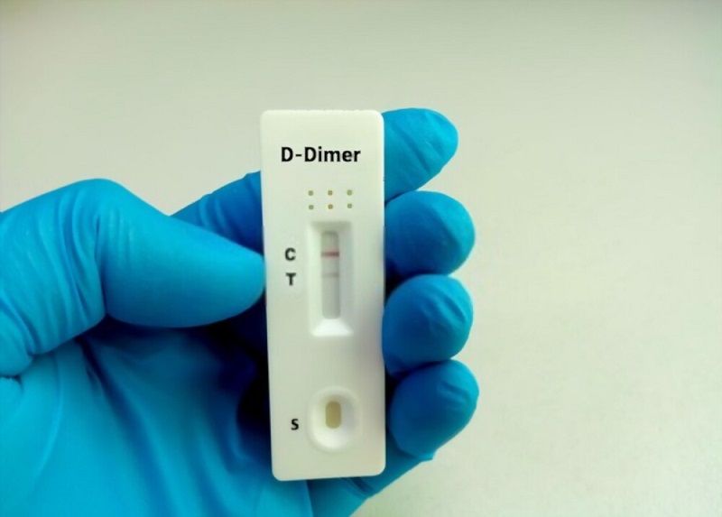 Xét nghiệm D-dimer bao nhiều tiền?