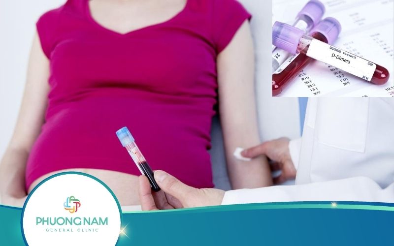 Xét Nghiệm D Dimer Khi Mang Thai – Những Vấn Đề Cần Lưu Ý