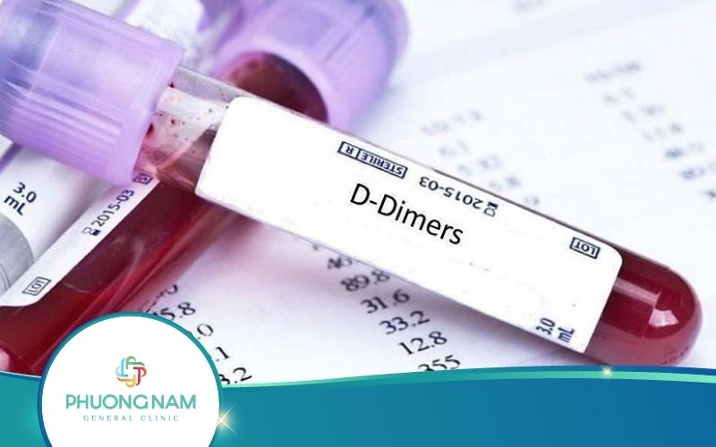 Xét Nghiệm D Dimer Là Gì? – Ý Nghĩa Và Quy Trình Thực Hiện