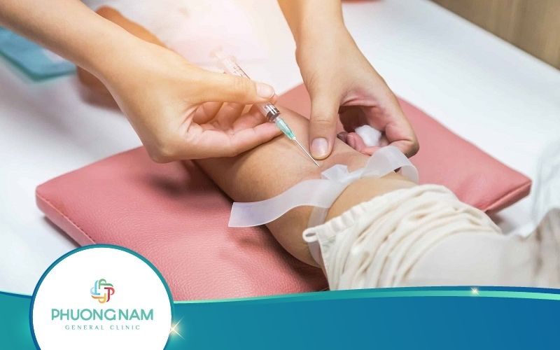 Điện Di Huyết Sắc Tố Là Gì? Khi Nào Chỉ Định Thực Hiện?