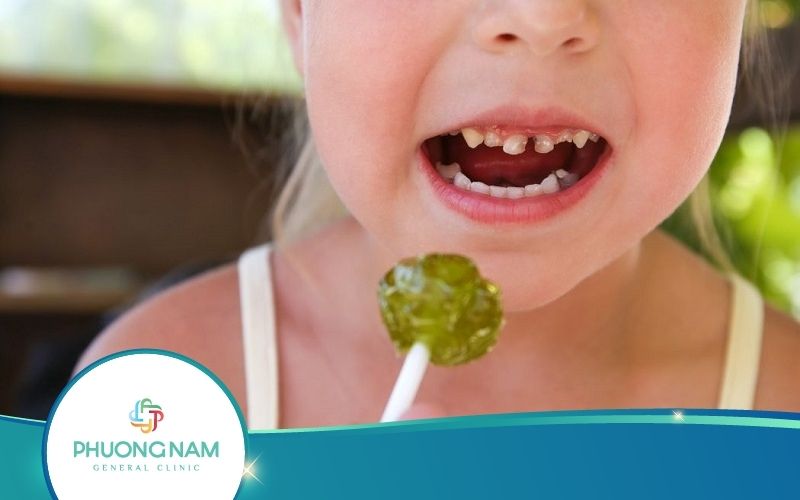 [Giải Đáp] Vì Sao Trẻ Nhỏ Ăn Kẹo Rất Dễ Bị Sâu Răng?