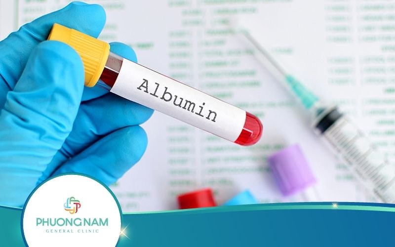 Quy Trình Xét Nghiệm Albumin Ra Sao? Khi Nào Cần Thực Hiện?