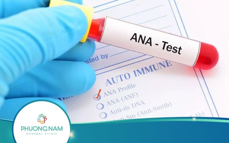 Xét Nghiệm ANA Là Gì? Quy Trình Thực Hiện Ra Sao?