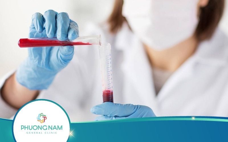 Xét Nghiệm Anti TPO Là Gì? Các Bước Tiến Hành Ra Sao?