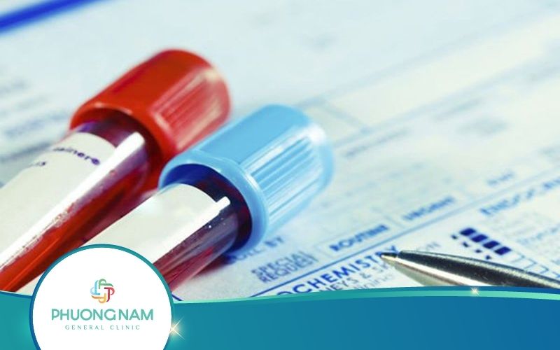 Khi Nào Cần Xét Nghiệm Antiphospholipid 7 Chỉ Số?