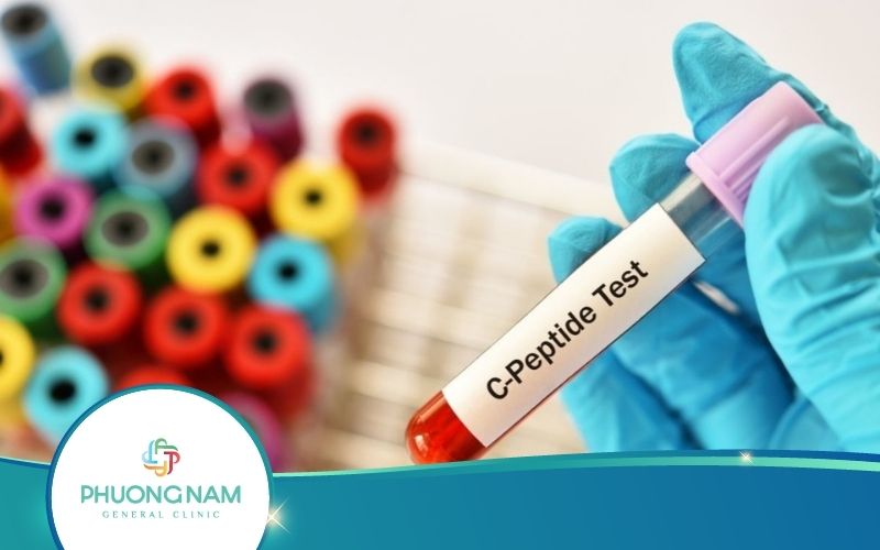 Xét Nghiệm C Peptide Nên Làm Khi Nào? Quy Trình Ra Sao?