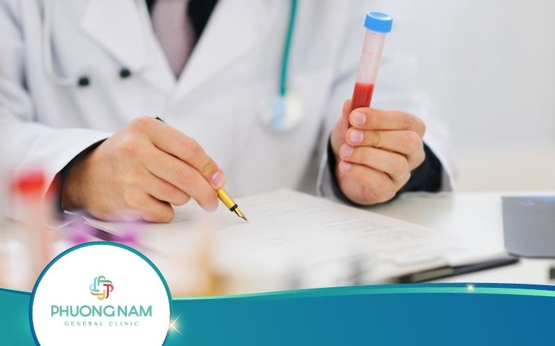 Xét Nghiệm Chức Năng Gan Là Gì? Có Những Loại Xét Nghiệm Nào?