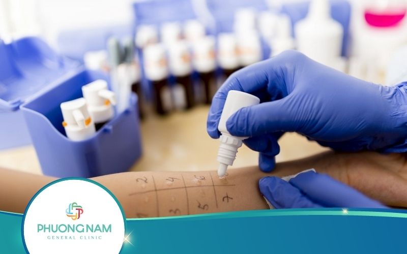 Xét Nghiệm Dị Ứng – Những Thông Tin Hữu Ích Cần Biết