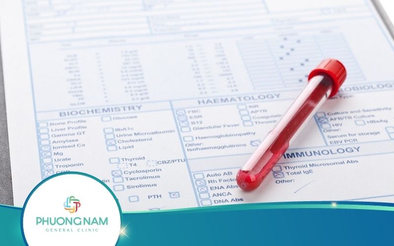 Xét Nghiệm Xuất Huyết Giảm Tiểu Cầu Gồm Những Gì?