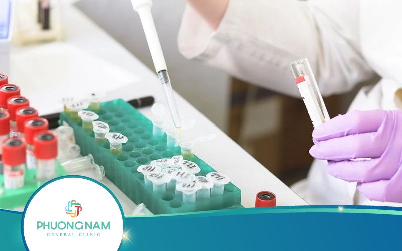 Xét Nghiệm Bổ Thể C3 Và C4 Có Vai Trò – Ý Nghĩa Ra Sao?