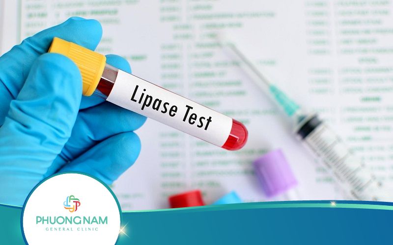 Xét Nghiệm Lipase Là Gì? Thực Hiện Ra Sao? Ý Nghĩa Thế Nào?