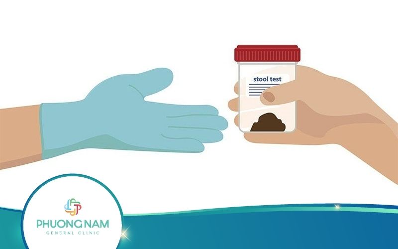 Xét Nghiệm Phân Là Gì? Khi Nào Cần Thực Hiện?