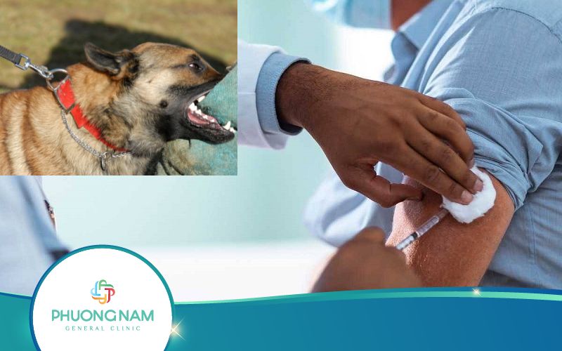 Hỏi Đáp: Bị Chó Cắn Lần 2 Có Cần Chích Ngừa Không?