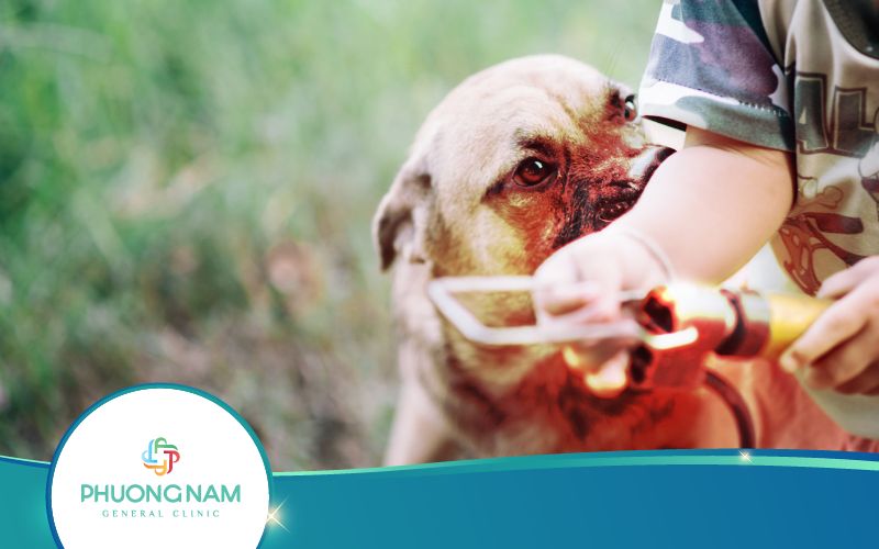 Bị Chó Cắn Sau 10 Ngày Cần Làm Gì? Bác Sĩ Giải Đáp!