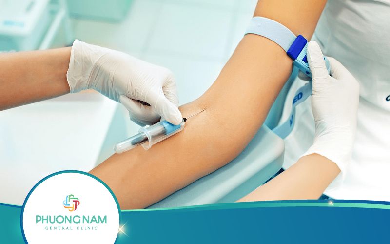 Hỏi: Sau Quan Hệ Bao Lâu Có Thể Xét Nghiệm Viêm Gan B?