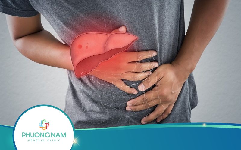 Viêm Gan B Có Chữa Được Không? Phòng Ngừa Thế Nào?