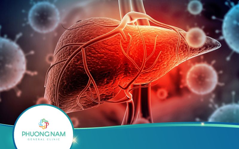 Viêm Gan B Mãn Tính – [Triệu Chứng, Chẩn Đoán, Điều Trị]