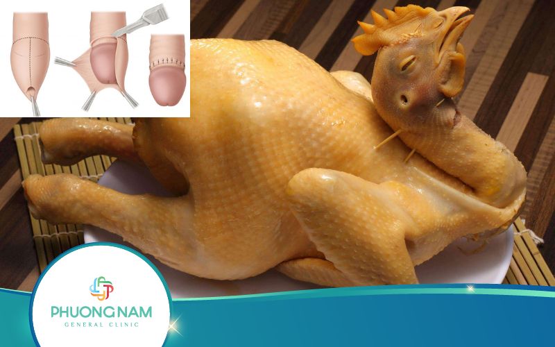 Hỏi Đáp: Cắt Bao Quy Đầu Ăn Thịt Gà Được Không?