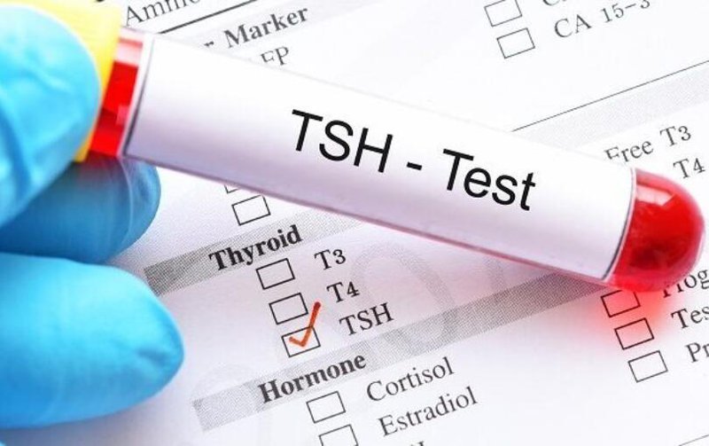 Chỉ số TSH trong ung thư tuyến giáp