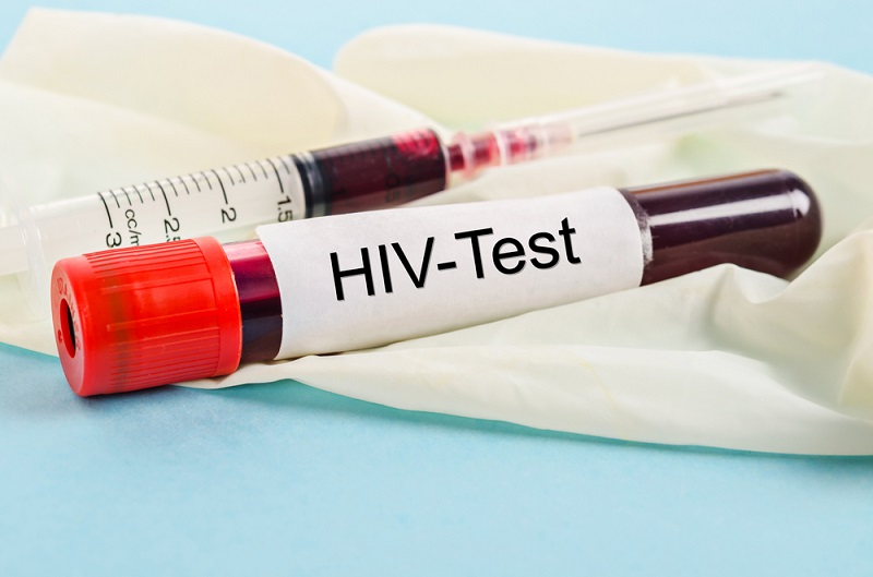 Để phát hiện một người có nhiễm HIV hay không người ta làm gì?