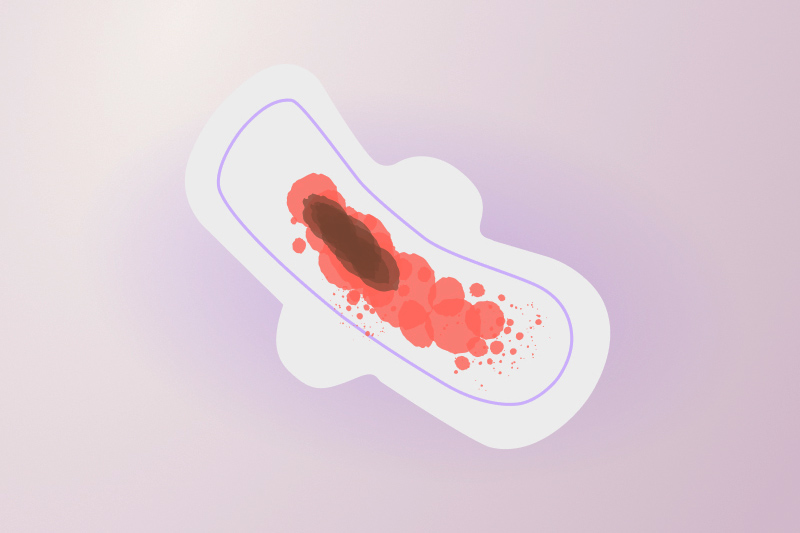 Trường hợp thai ngoài tử cung thể huyết tụ thành nang
