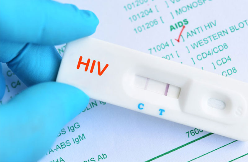 Xét nghiệm Anti HIV là gì?