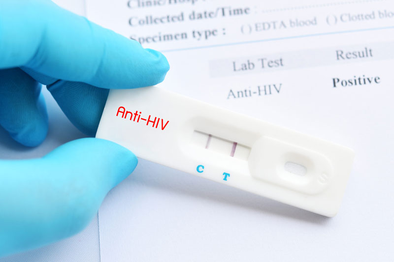 Mục đích của việc tiến hành xét nghiệm Anti HIV