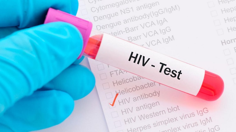 Xét nghiệm HIV để làm gì?