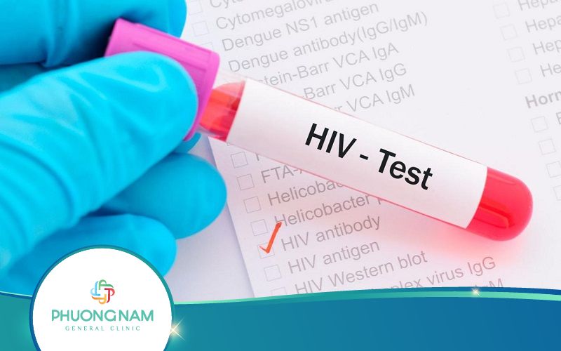 Giải Đáp: Xét Nghiệm HIV Bao Lâu Có Kết Quả? 