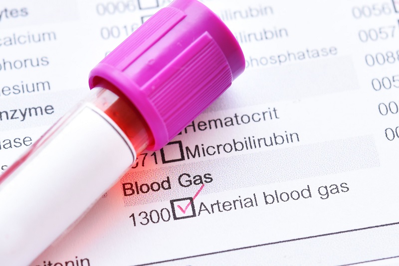 Xét nghiệm khí máu động mạch là gì, có ý nghĩa như thế nào?