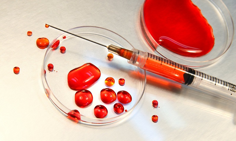 Xét nghiệm máu bình thường có phát hiện ra HIV không?