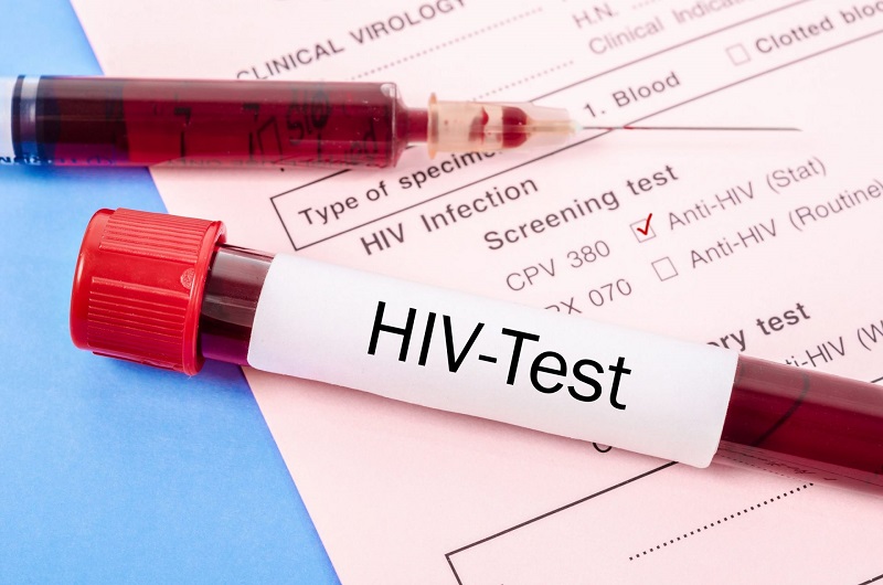 Những phương pháp xét nghiệm HIV chính xác nhất hiện nay