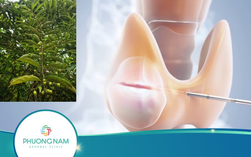Dùng Cây Xạ Đen Chữa U Tuyến Giáp Có Tác Dụng Gì?