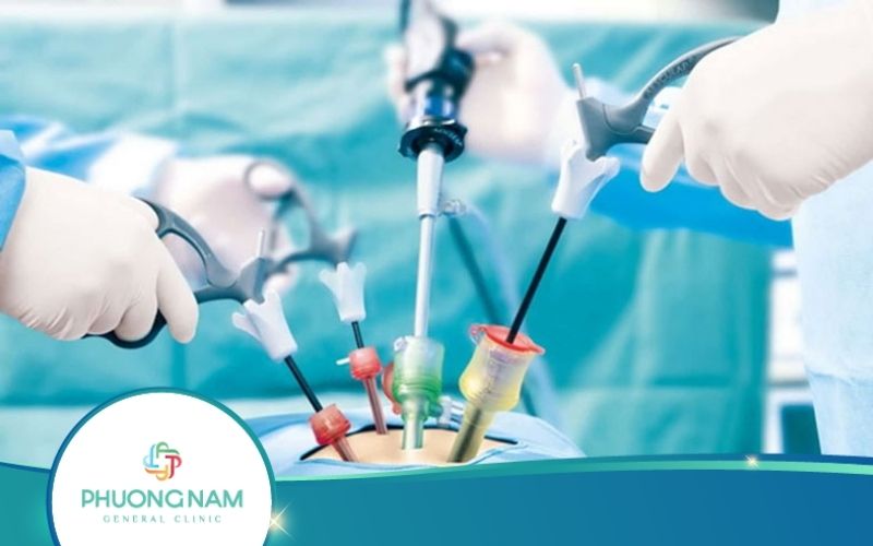 Biến Chứng Sau Mổ Ruột Thừa Nội Soi Cần Lưu Ý