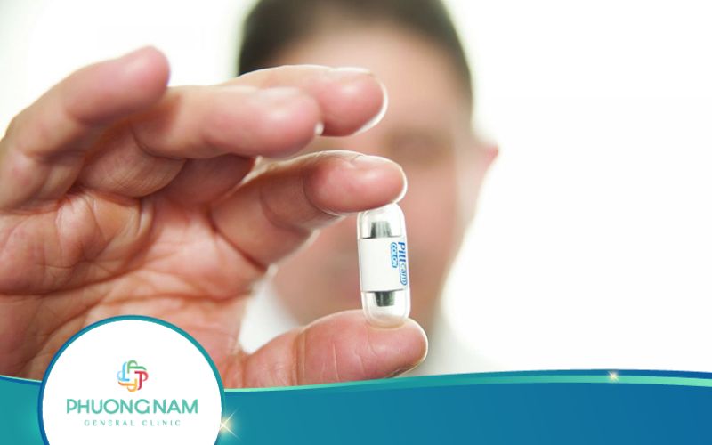 Nội Soi Dạ Dày Bằng Viên Nang Là Gì?