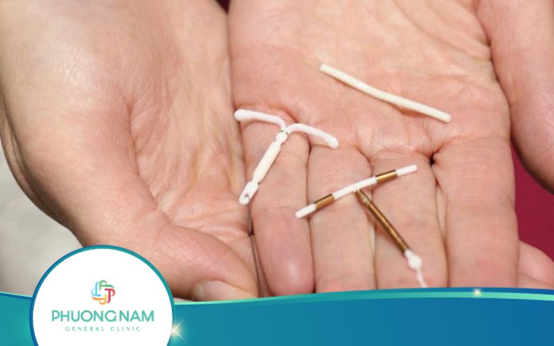 Các Tư Thế Quan Hệ Sau Khi Đặt Vòng Tránh Thai
