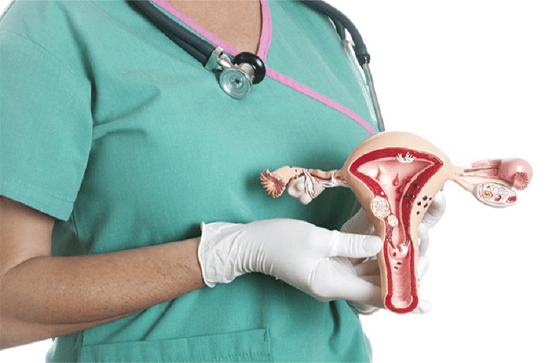 Phẫu thuật nội soi cắt tử cung hoàn toàn là gì?
