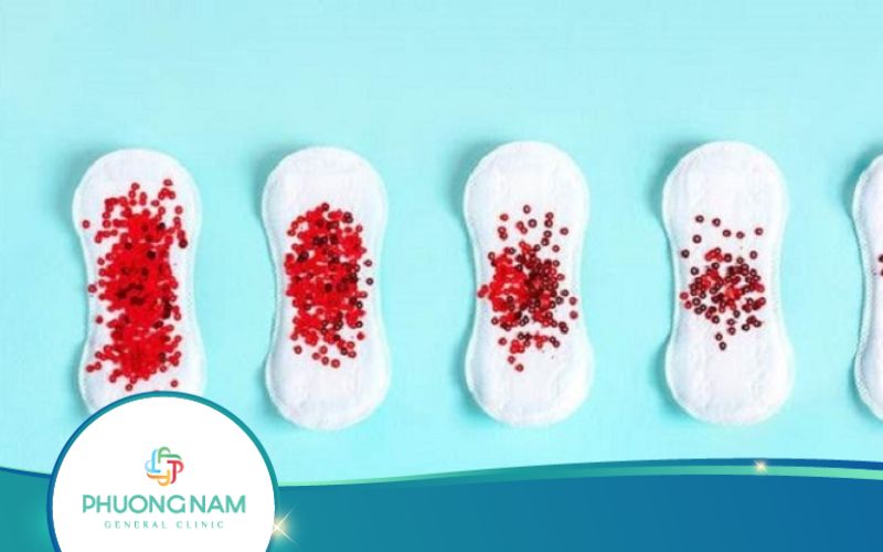 Hiện Tượng Rong Kinh Tiền Mãn Kinh